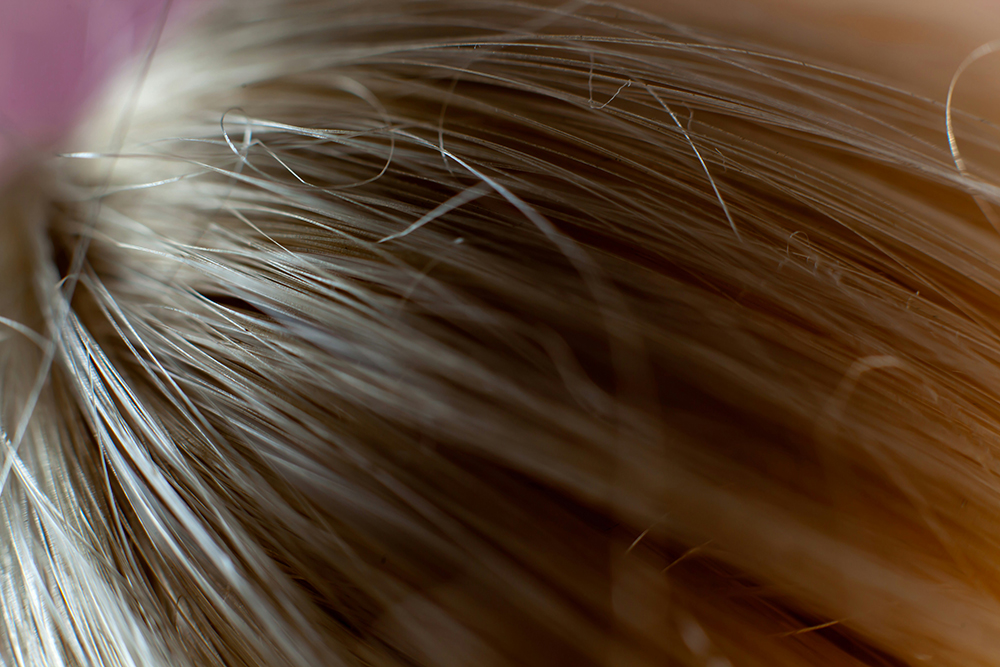 Guía para prescribir suplementación para el cabello