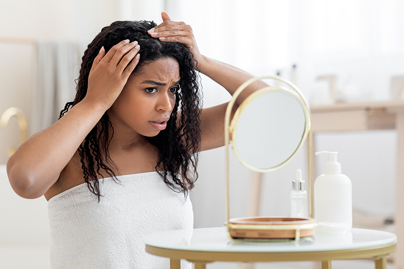 Everything You Need to Know about Hair Loss