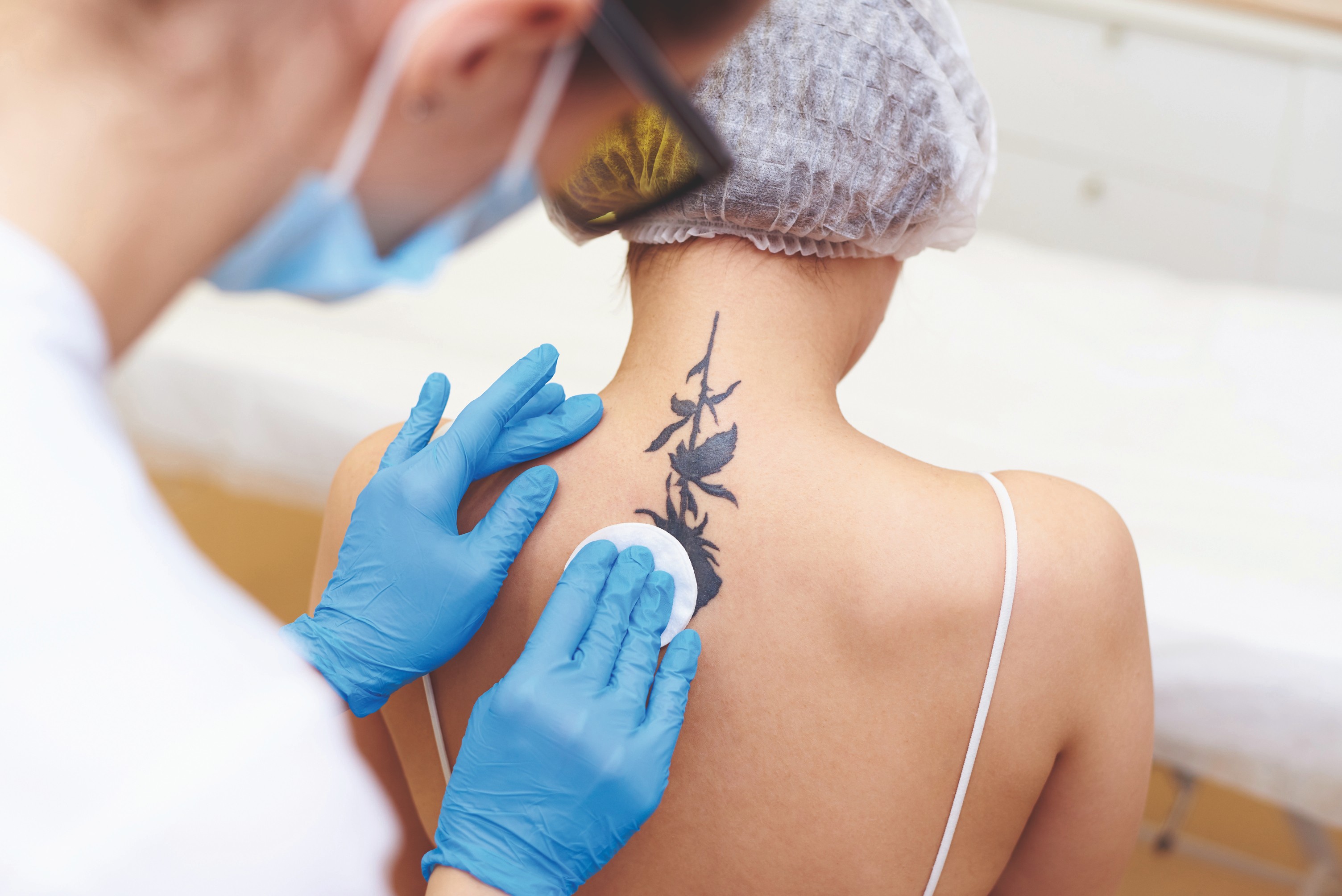 Expand your offering and boost business with laser tattoo removal