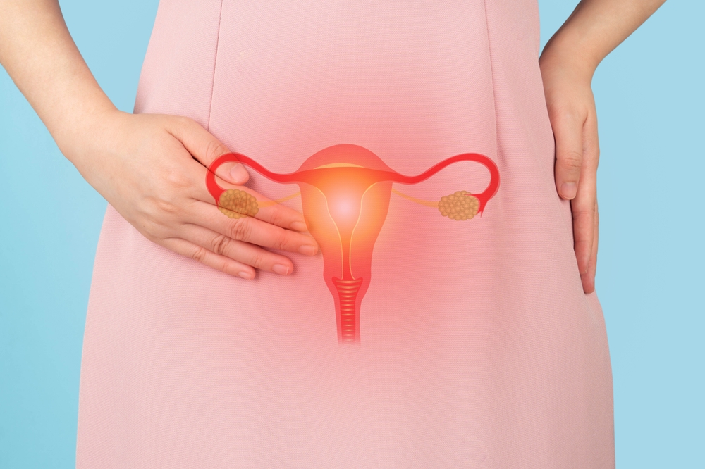 Managing PCOS symptoms