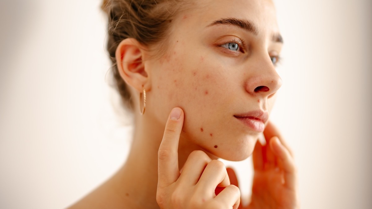 The skin’s immune system: how inflammation starts and how therapists can support it