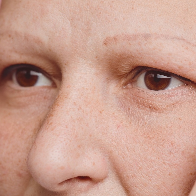 How semi-permanent makeup can help alopecia clients regain confidence
