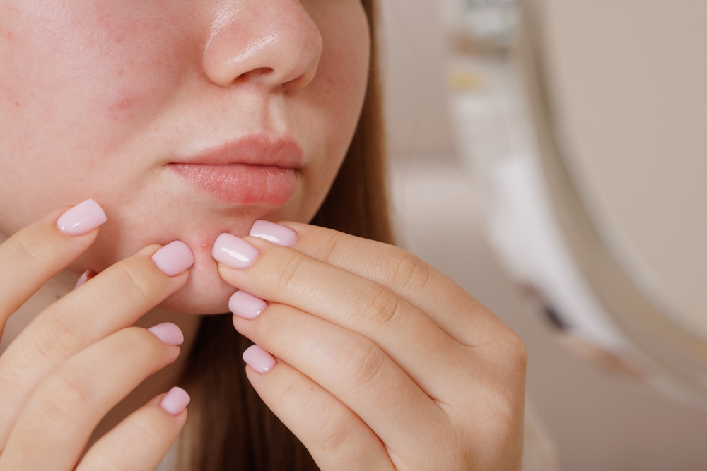 How to care for stressed-out skin