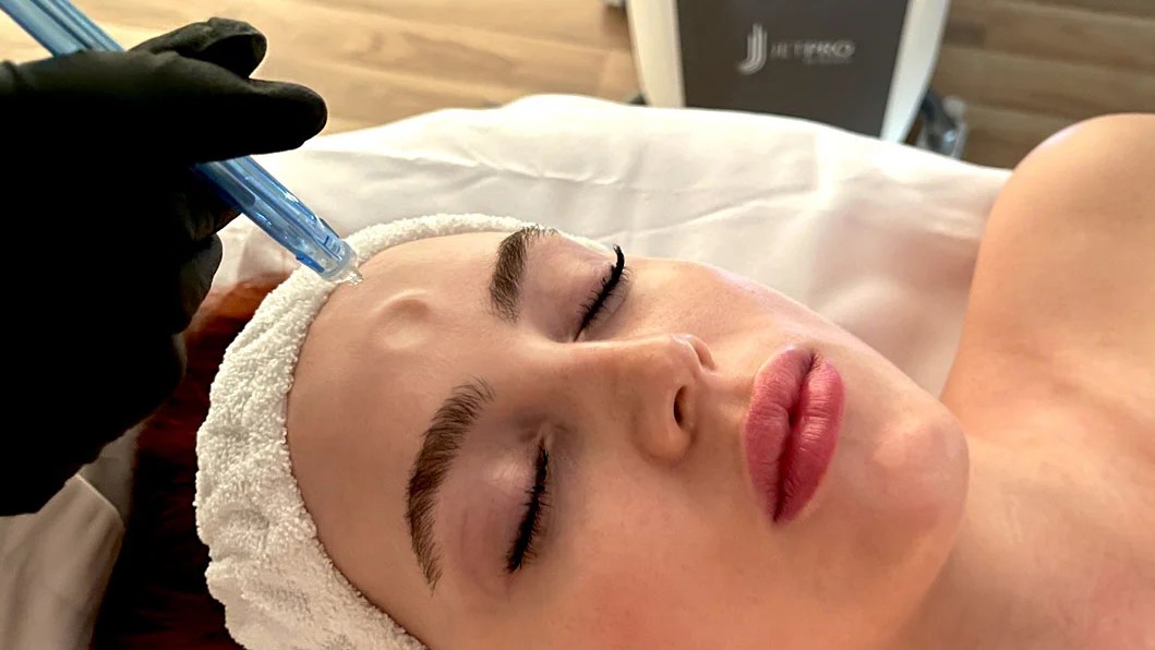 Así es JetPeel, técnica antiedad con oxígeno y principios activos