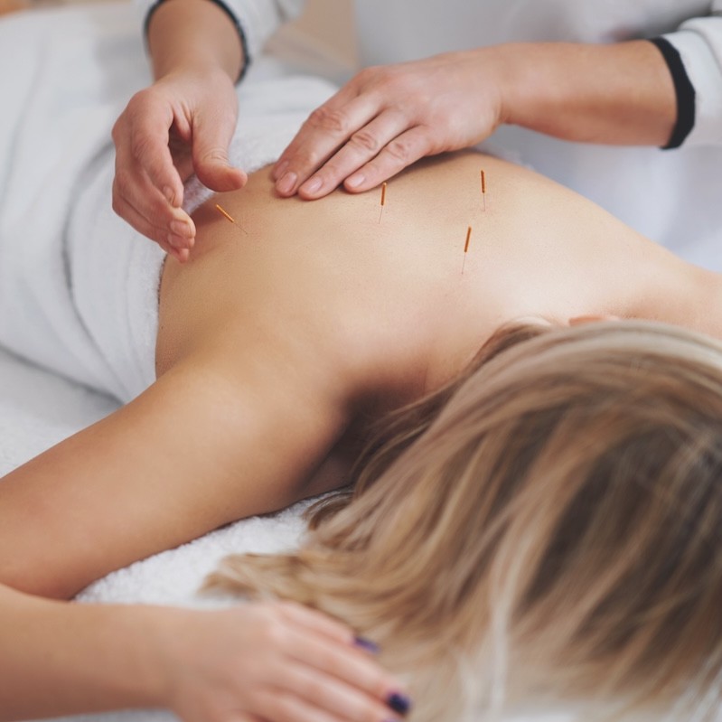 5 ways to integrate Traditional Chinese Medicine into salon and clinic treatments