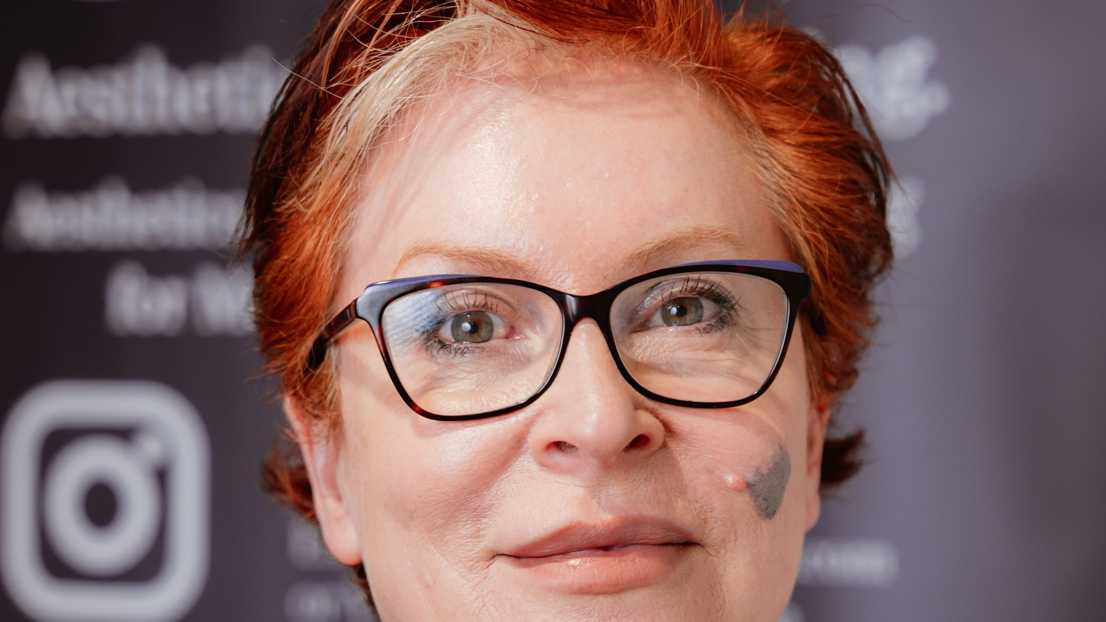 The GLP-1 Era and Facial Aesthetics at AM London 2026