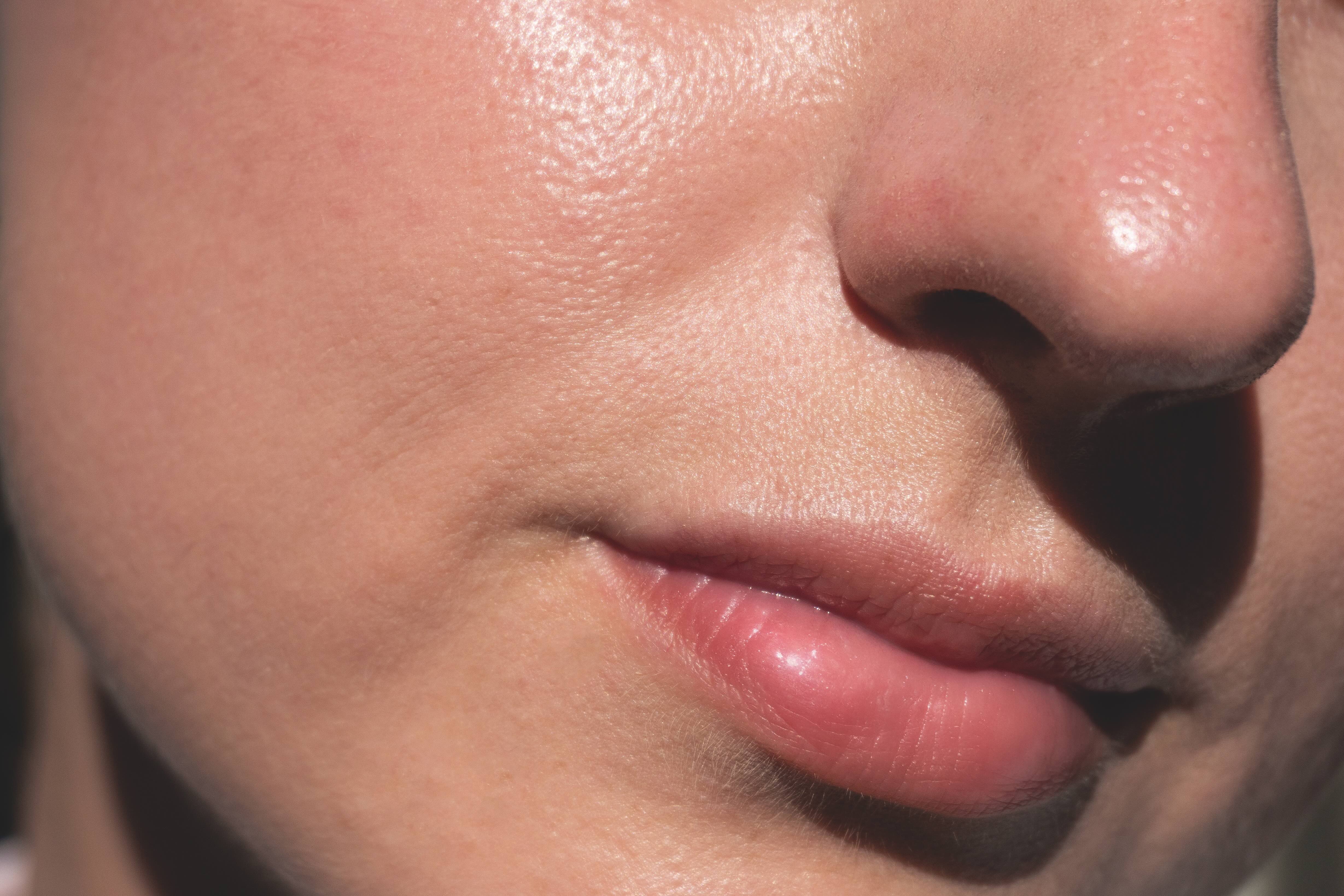 Skin boosters explained: HA vs biorevitalisers vs polynucleotides