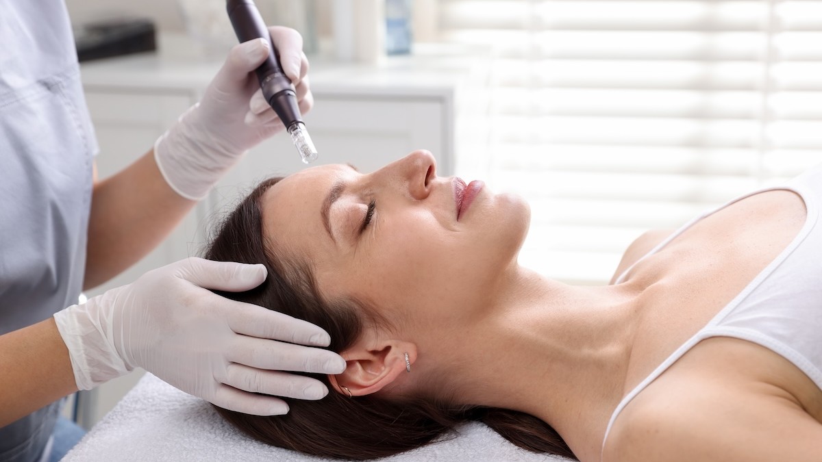 Microneedling safety guide launched for beauty professionals