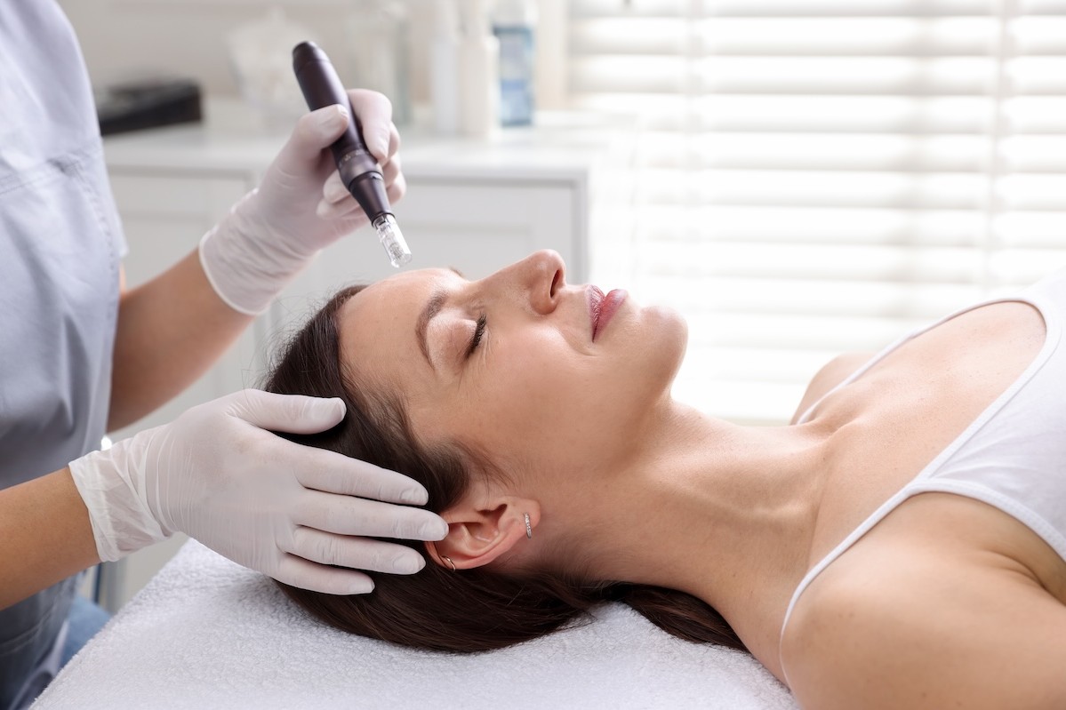 Microneedling safety guide launched for beauty professionals
