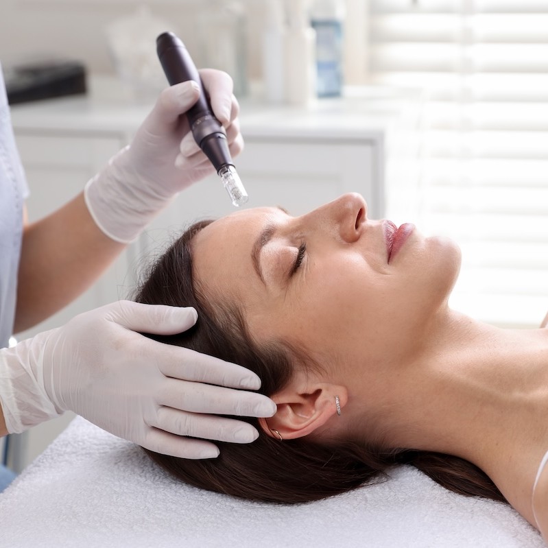 Microneedling safety guide launched for beauty professionals