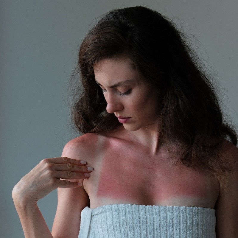 UV radiation labelled a “preventable public health crisis” in new parliamentary report