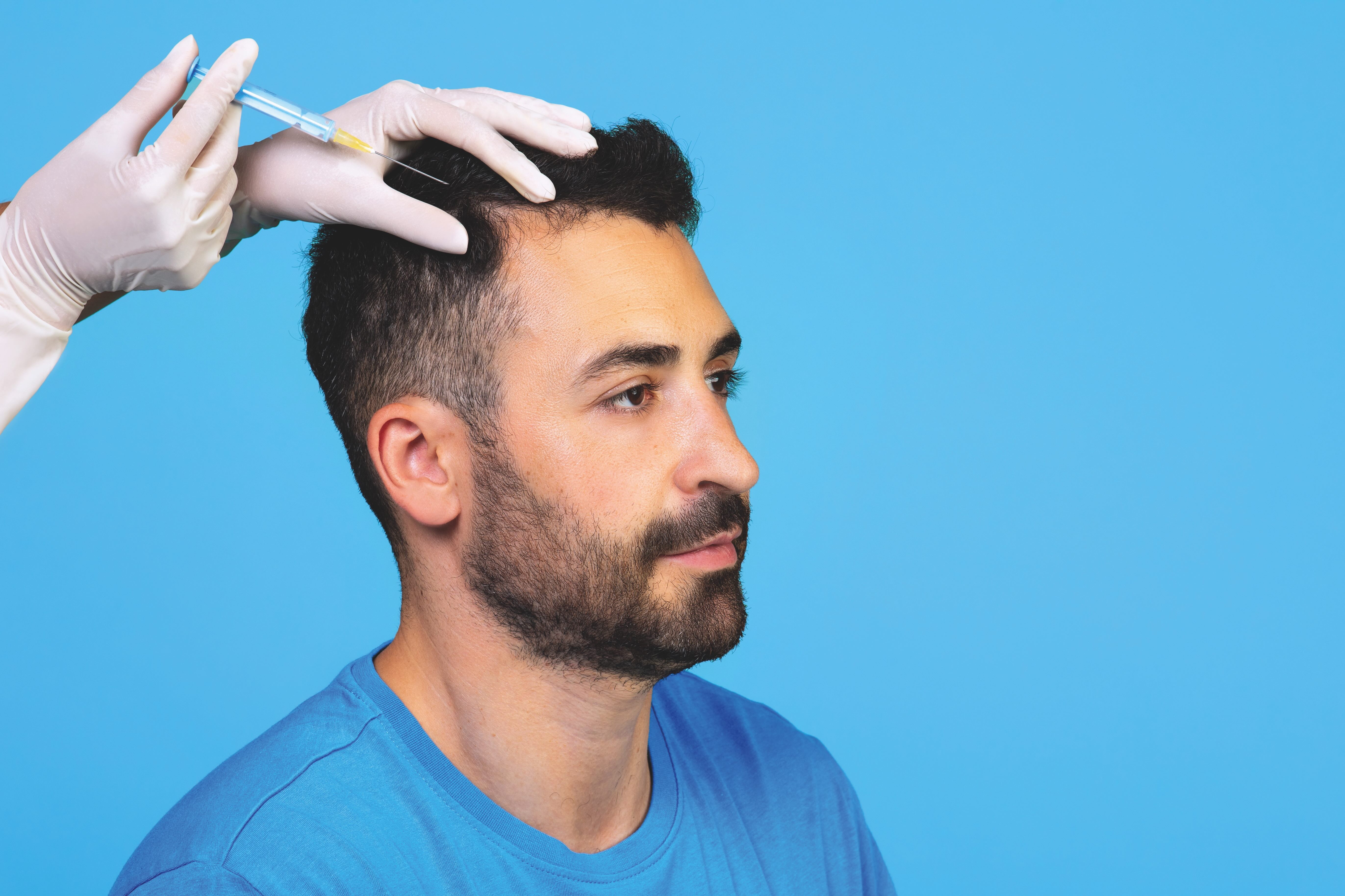 Hair restoration in 2026: How regenerative medicine is transforming male hair loss treatment
