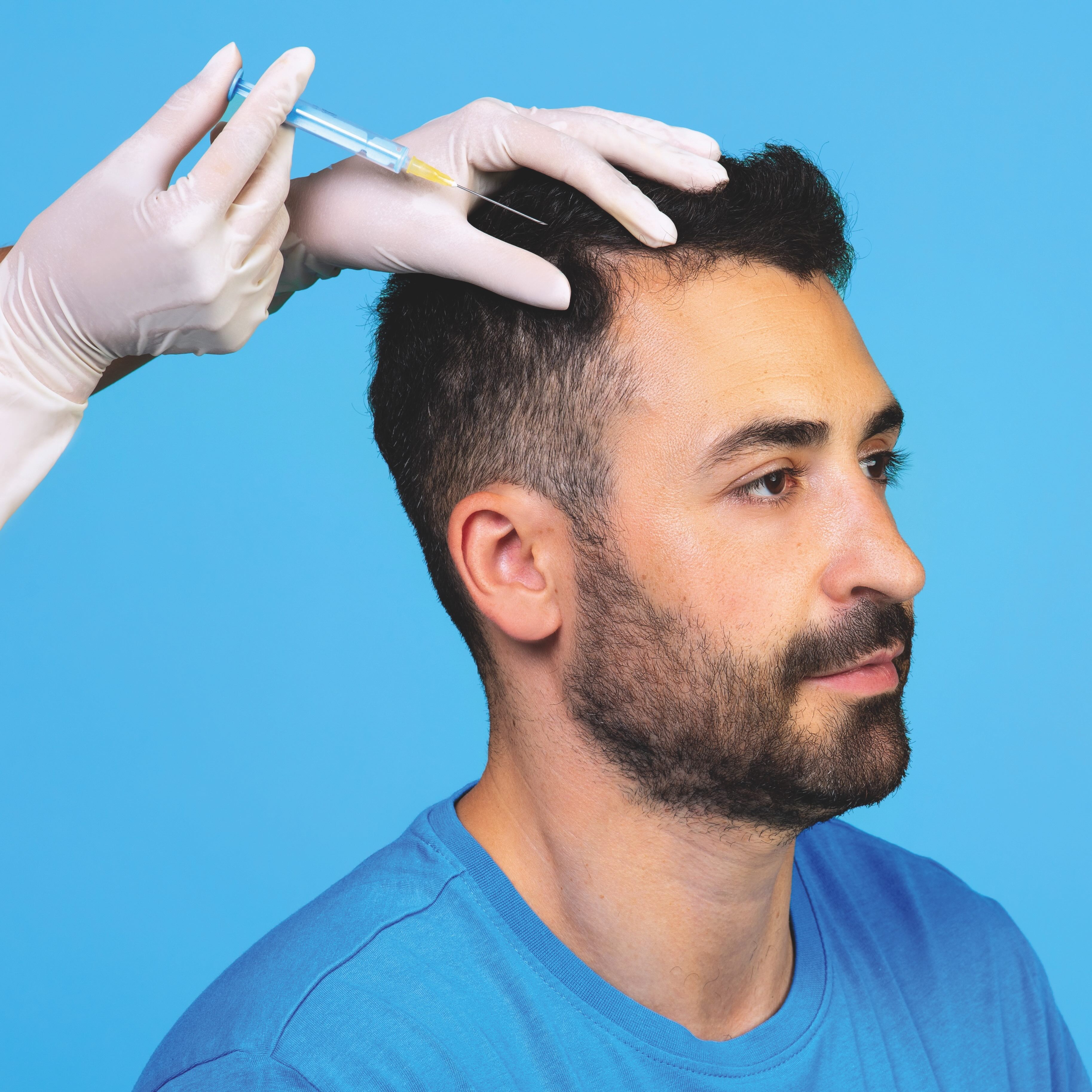Hair restoration in 2026: How regenerative medicine is transforming male hair loss treatment