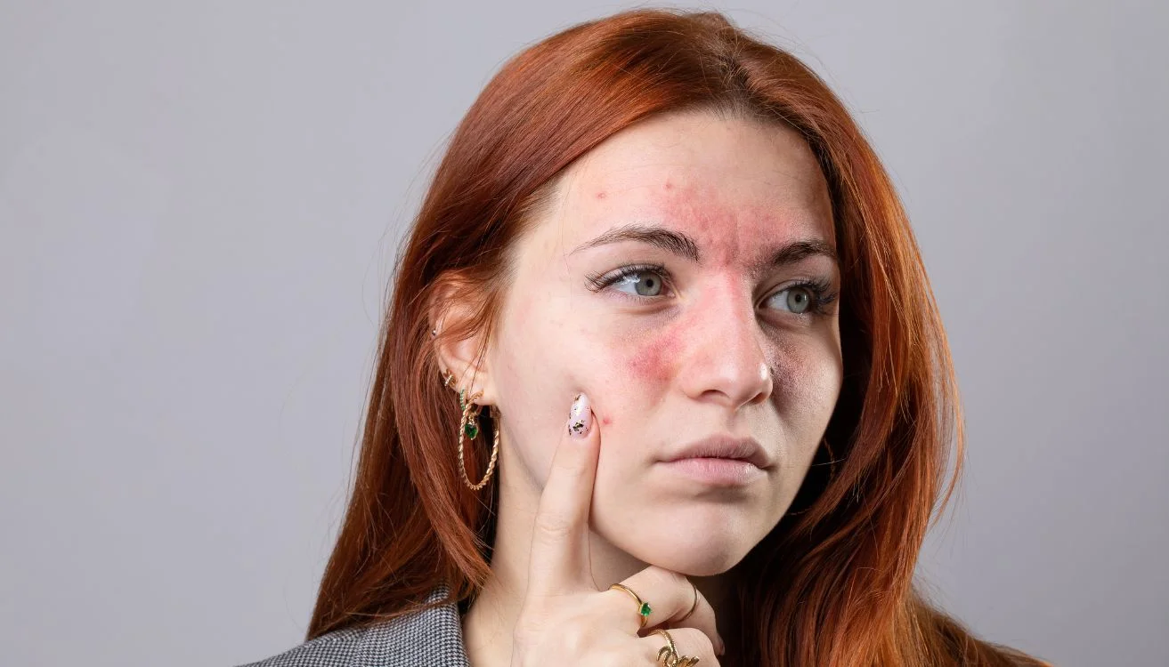 Why everyone is suddenly talking about facial inflammation