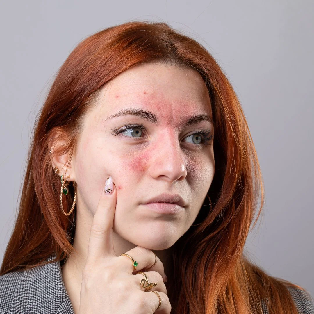 Why everyone is suddenly talking about facial inflammation