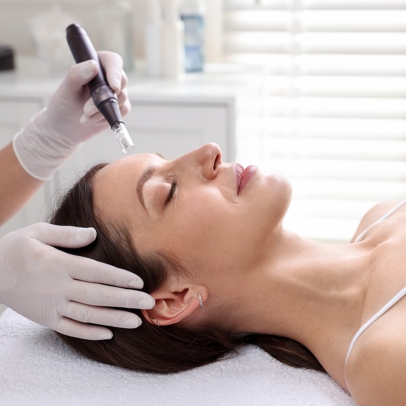 Microneedling safety guide launched for beauty professionals