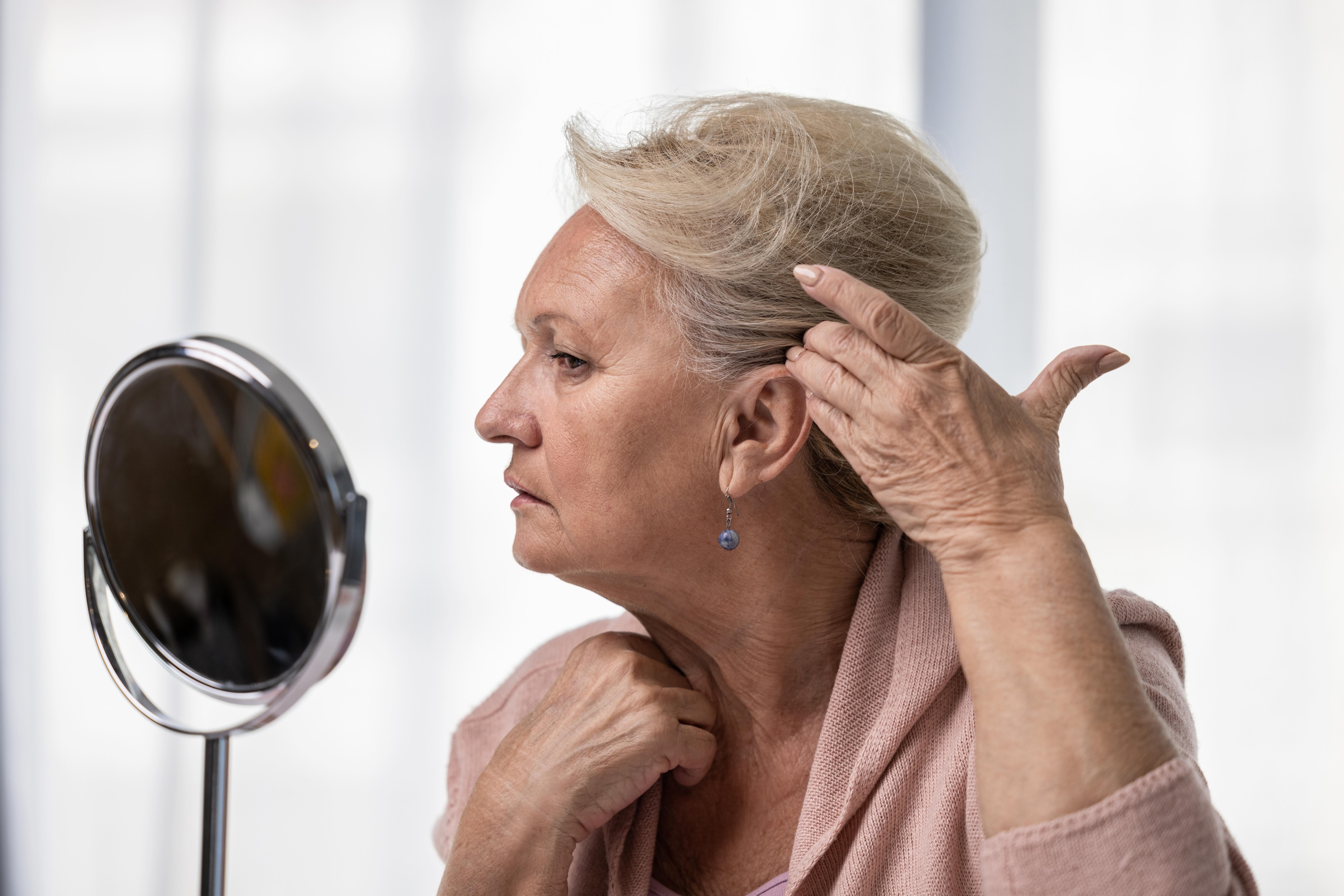 Does a facelift really slip?
