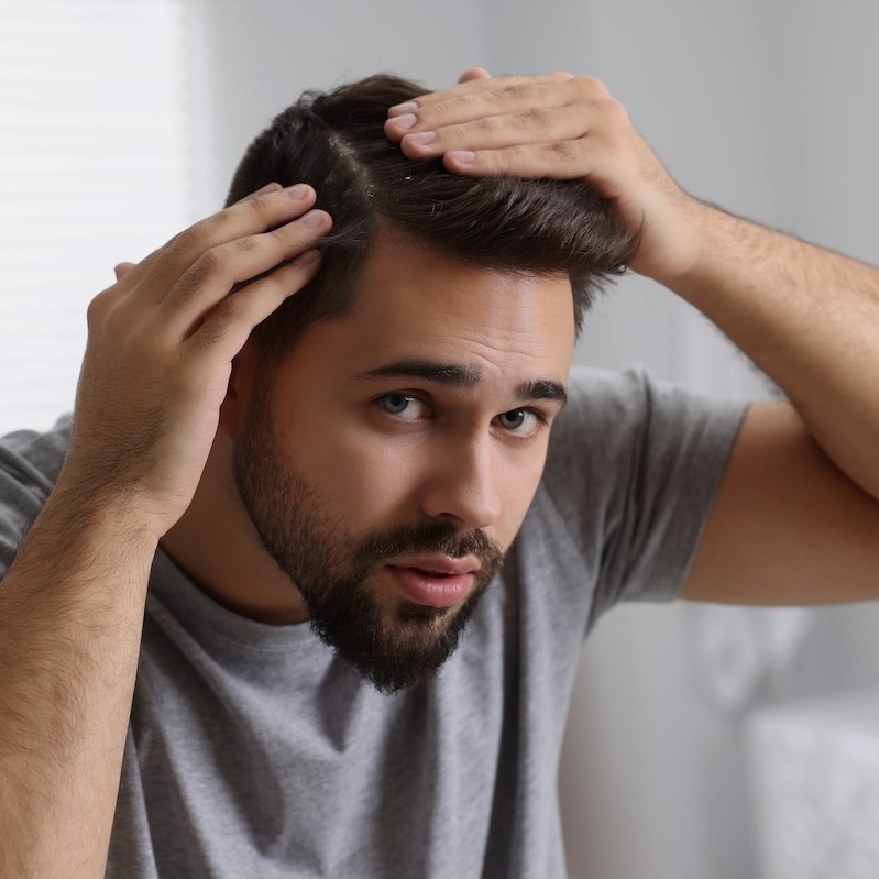  Men Could Be Washing Their Hair Wrong as Searches for Men’s Dandruff Surge