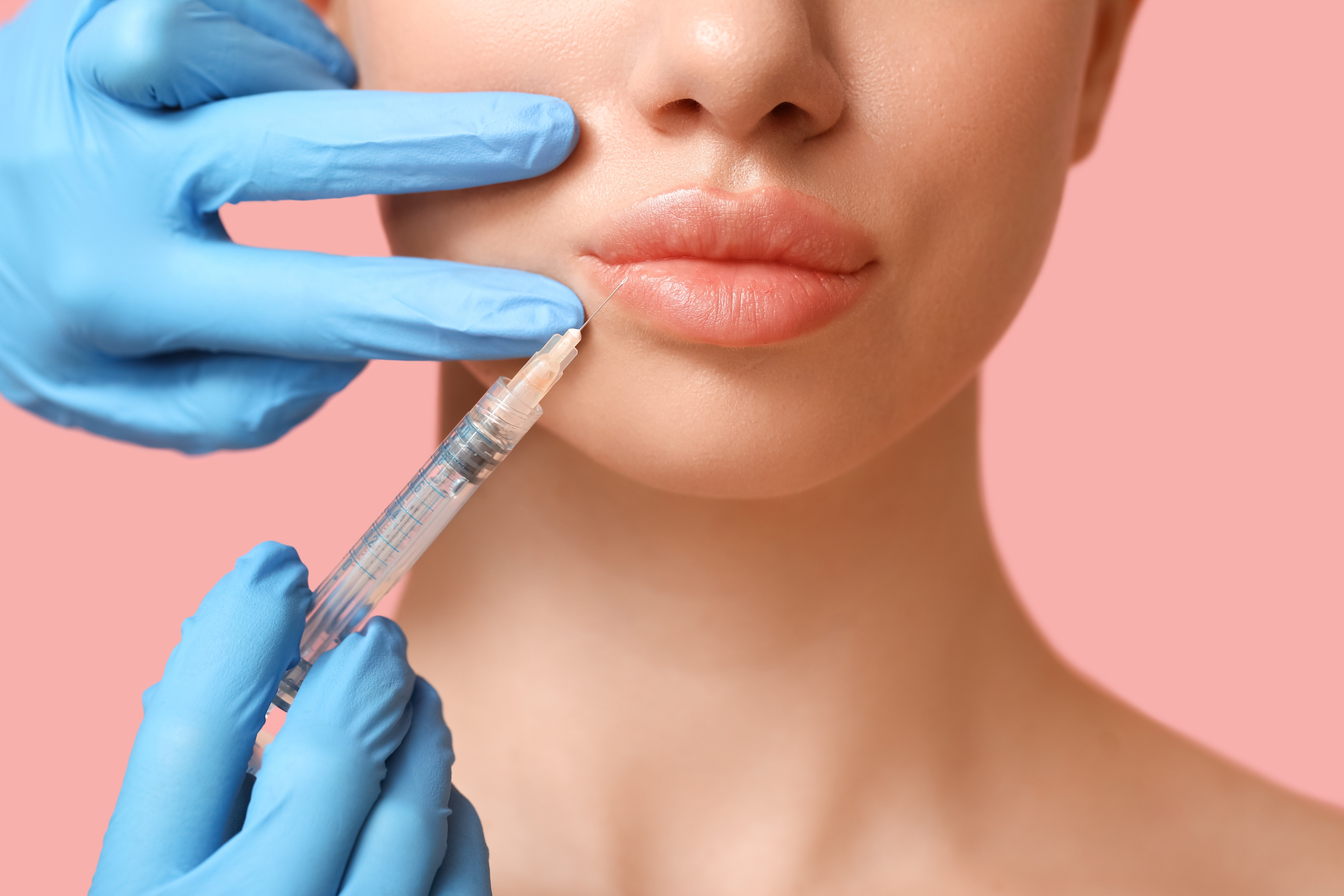 Which UK region has the highest interest in lip filler?