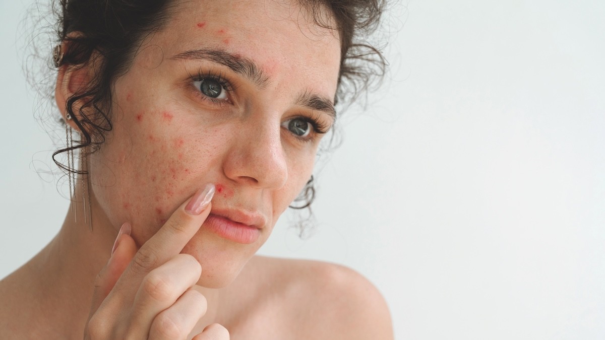 How health and lifestyle factors can affect skin treatment results