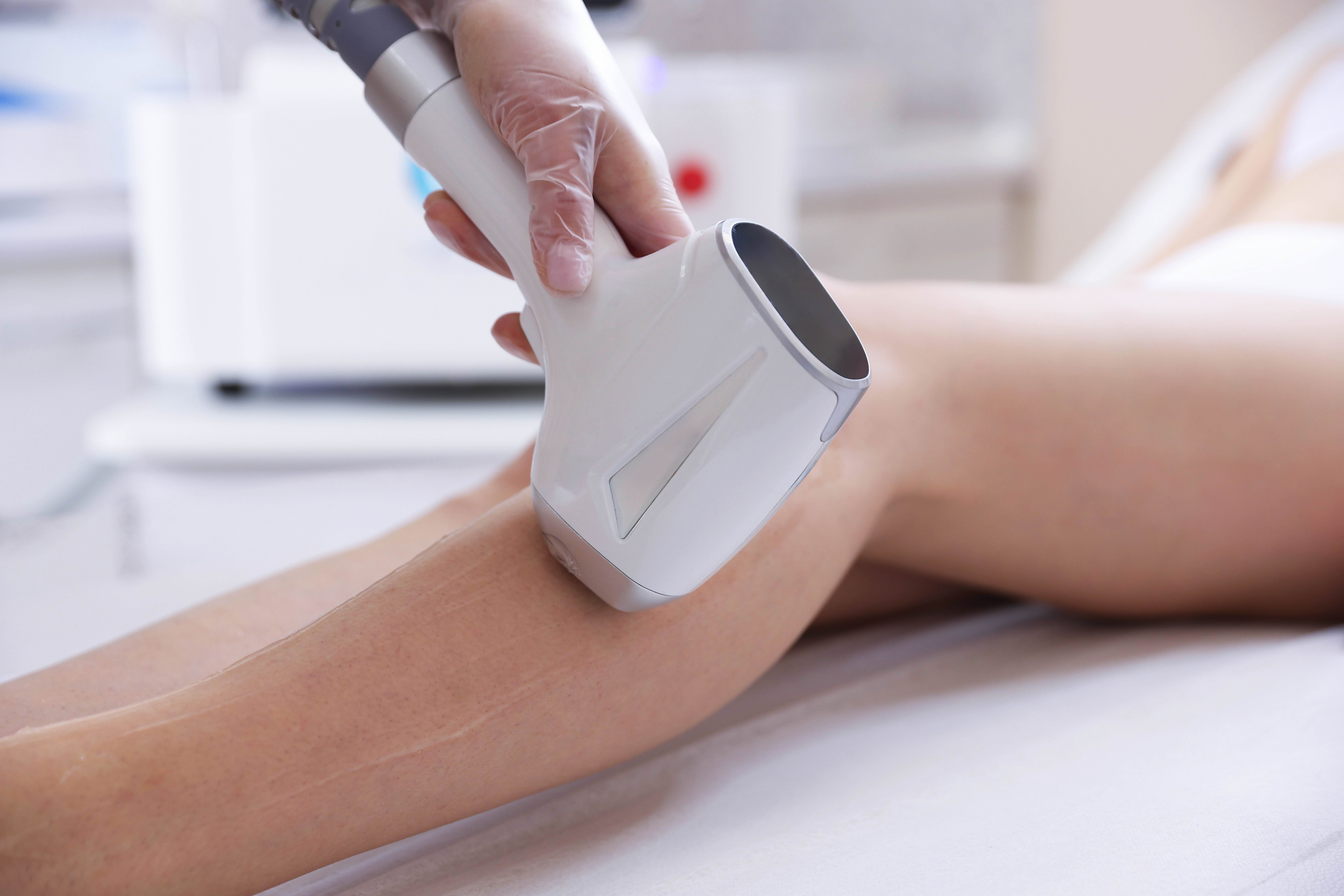 Why does PMOS require a different approach to laser hair removal?