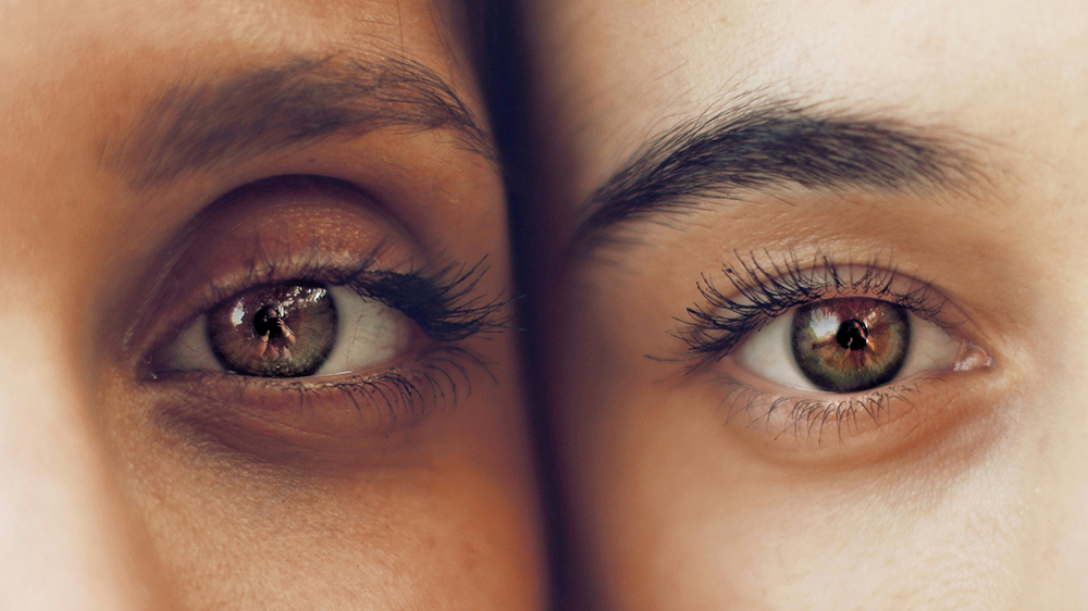 Ojeras: por qué se producen y cómo tratarlas con la Dra. Svetlana Babentsova