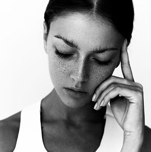 El acne no tiene sitio para estar en tu cara